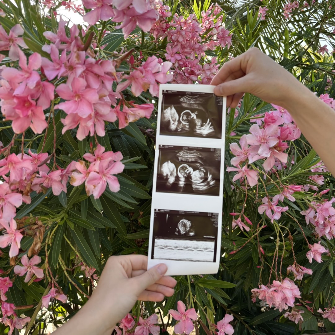 Photo shared by Madi for their Babylist baby registry.