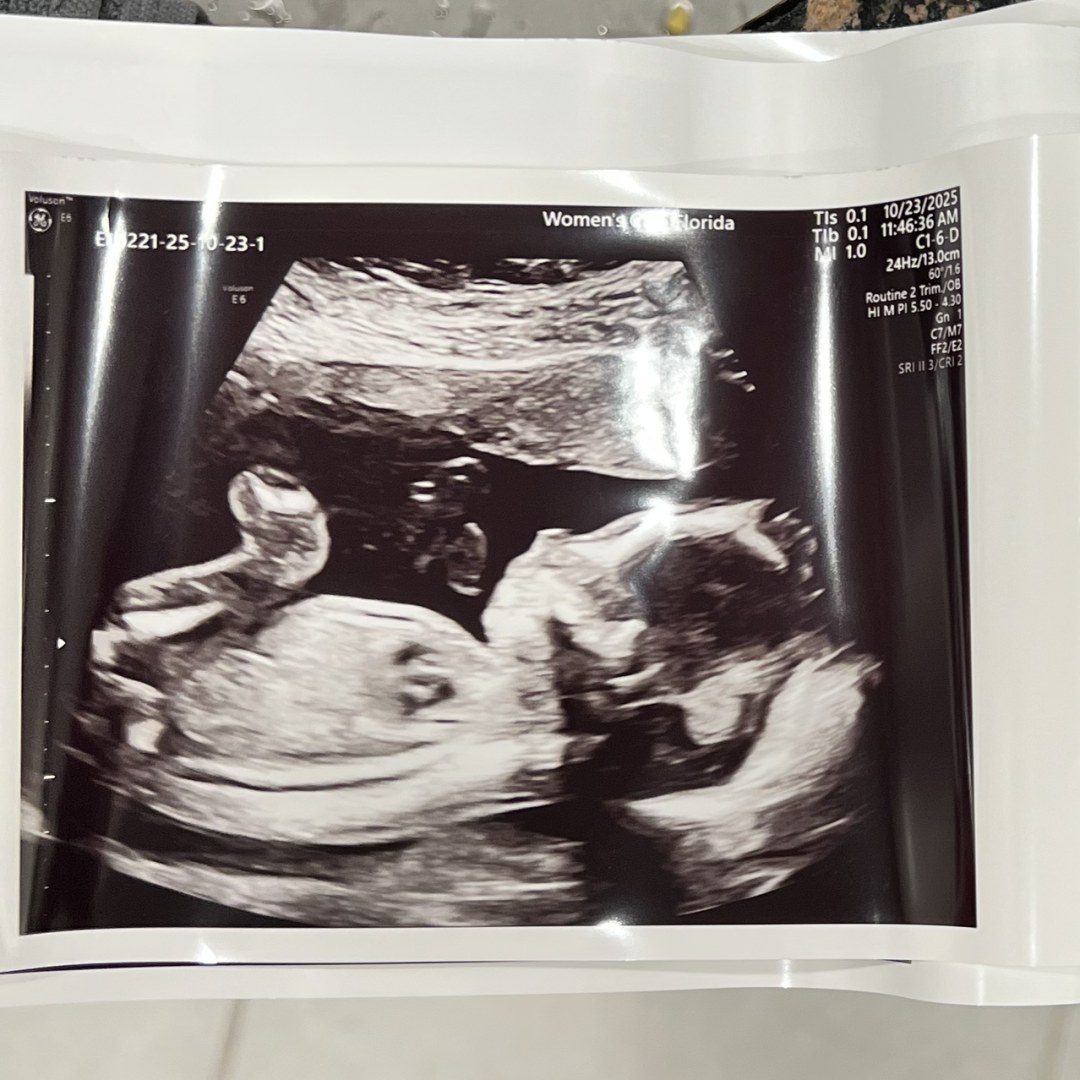 Photo shared by Courtney for their Babylist baby registry.