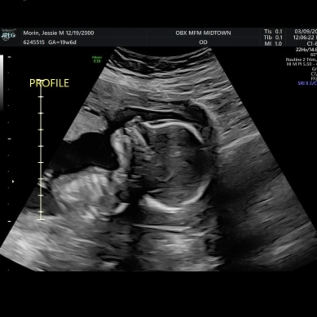 Photo shared by Jessie for their Babylist baby registry.