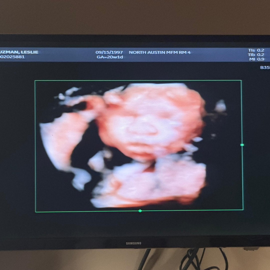 Photo shared by Leslie for their Babylist baby registry.