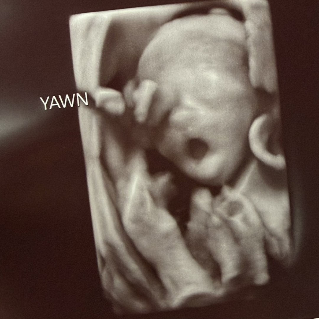 Photo shared by Hannah for their Babylist baby registry.