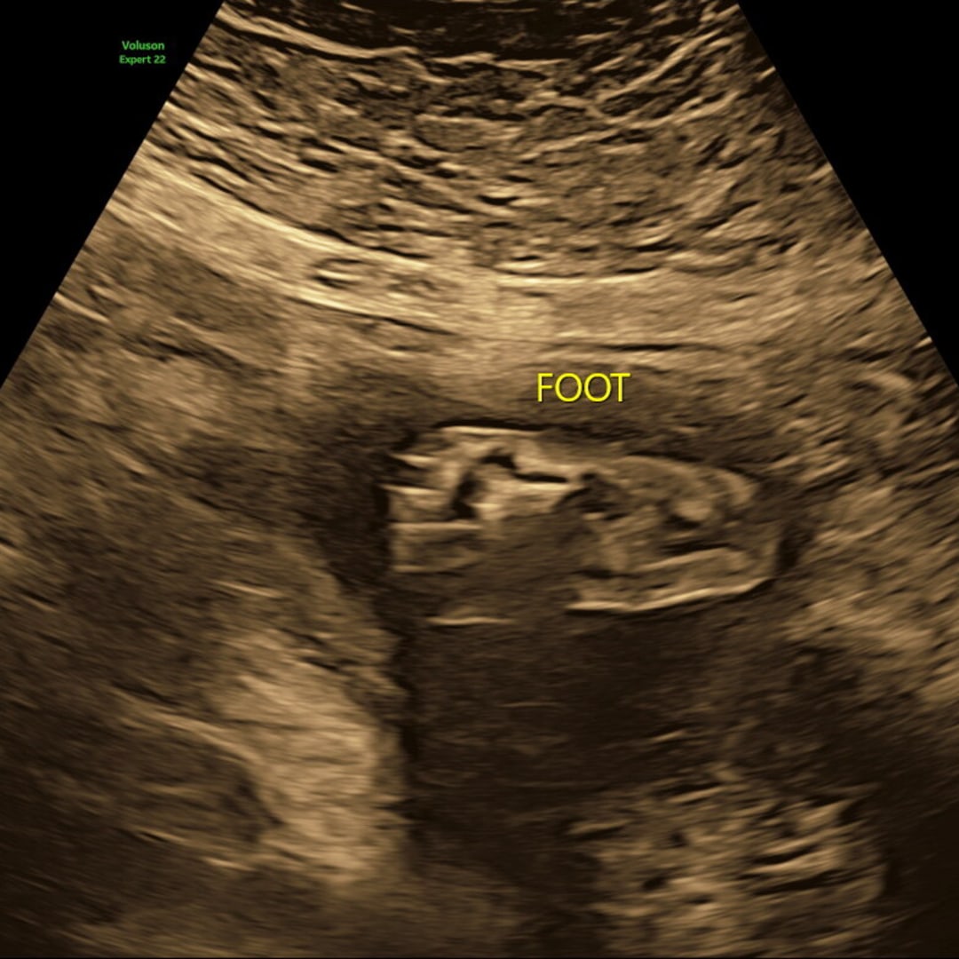 Photo shared by Ashley for their Babylist baby registry.