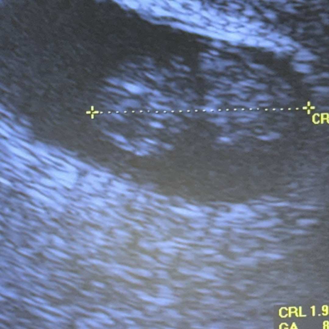 Photo shared by Sofia for their Babylist baby registry.