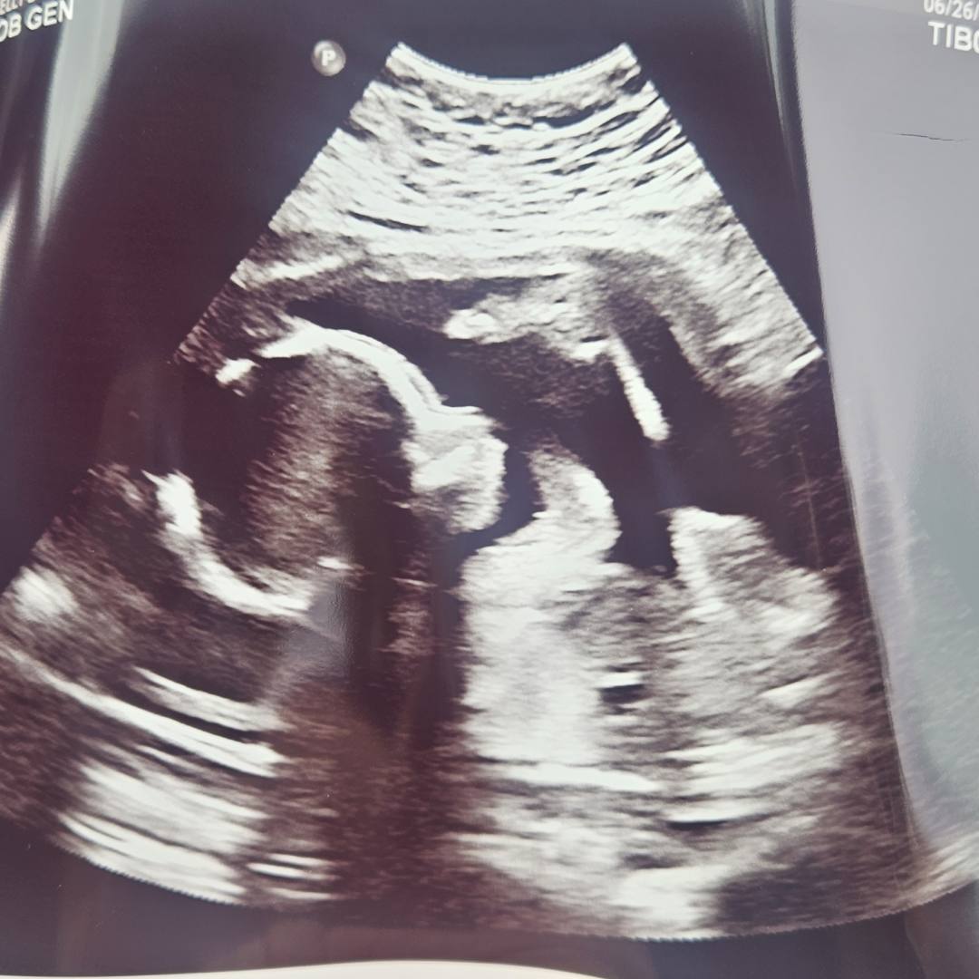 Photo shared by Kelly for their Babylist baby registry.