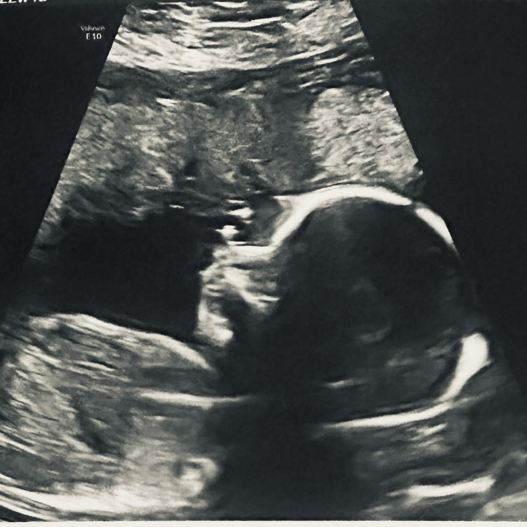 Photo shared by Ceara for their Babylist baby registry.