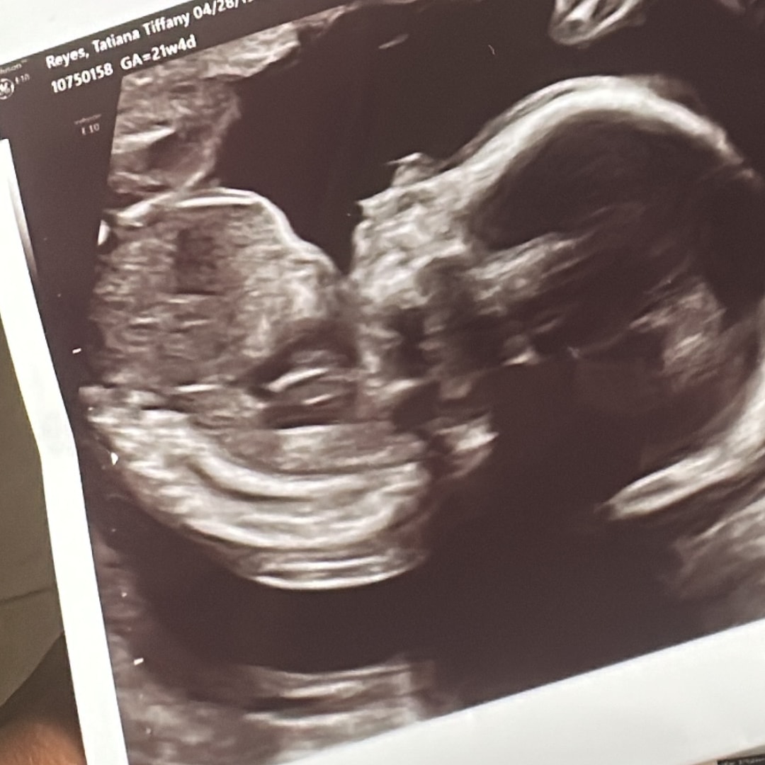 Photo shared by Tatiana for their Babylist baby registry.