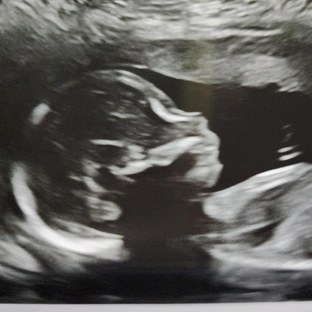 Photo shared by SANDRA for their Babylist baby registry.