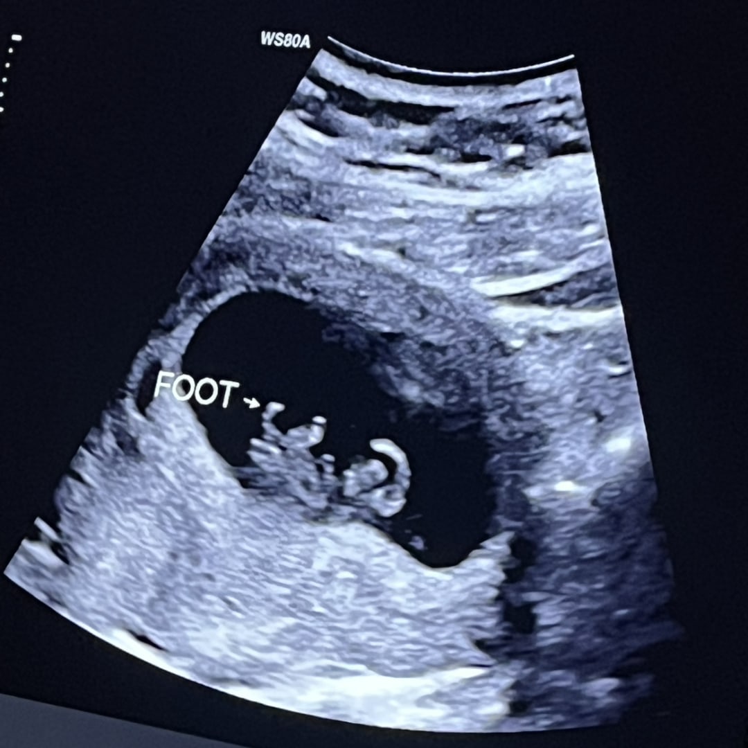 Photo shared by Erin for their Babylist baby registry.