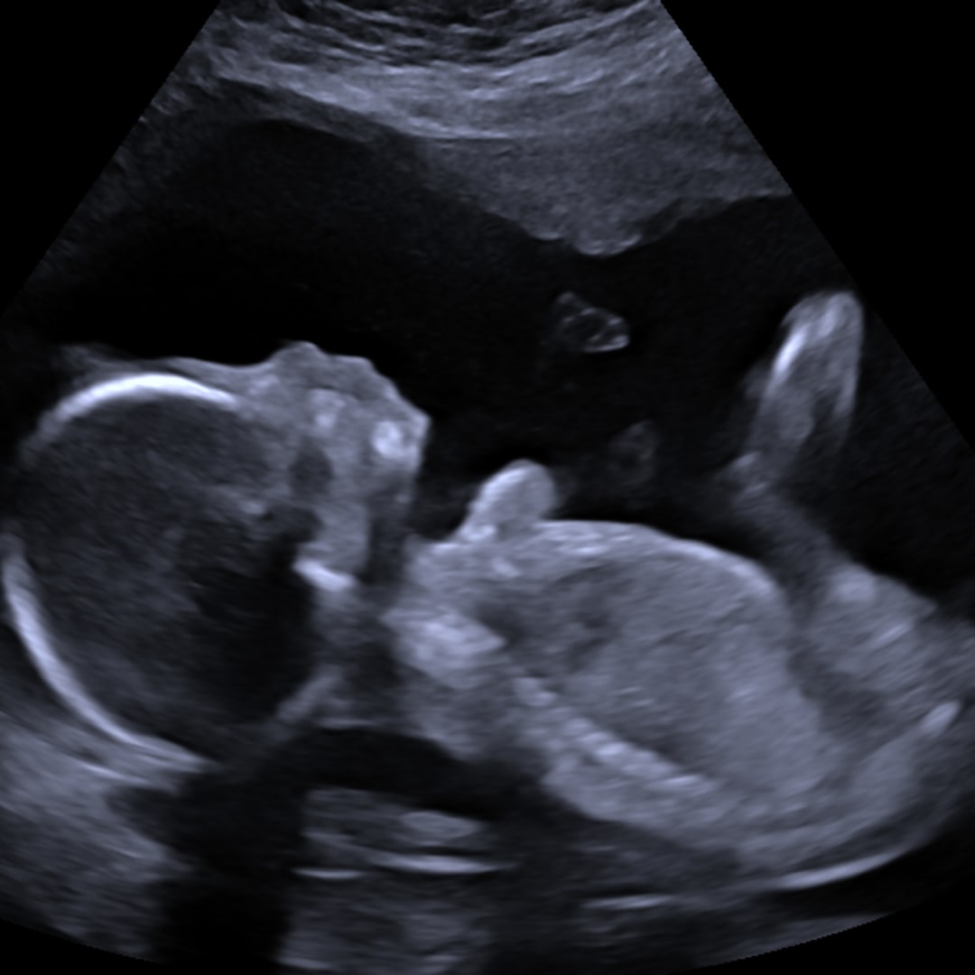 Photo shared by Natalia for their Babylist baby registry.