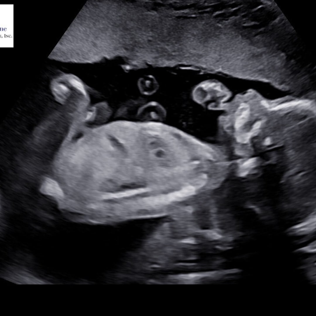 Photo shared by Alexandra for their Babylist baby registry.