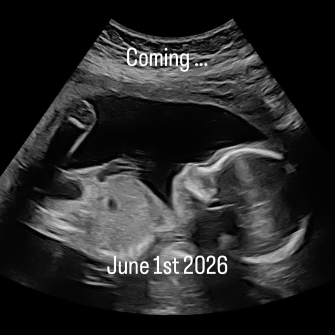 Photo shared by Megan for their Babylist baby registry.