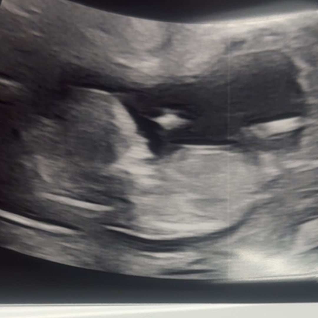 Photo shared by Marissa for their Babylist baby registry.