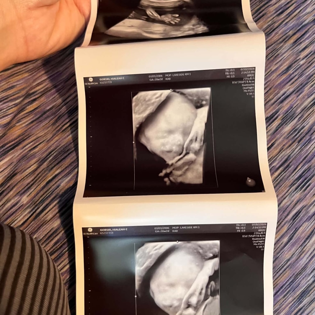 Photo shared by Hialeah for their Babylist baby registry.