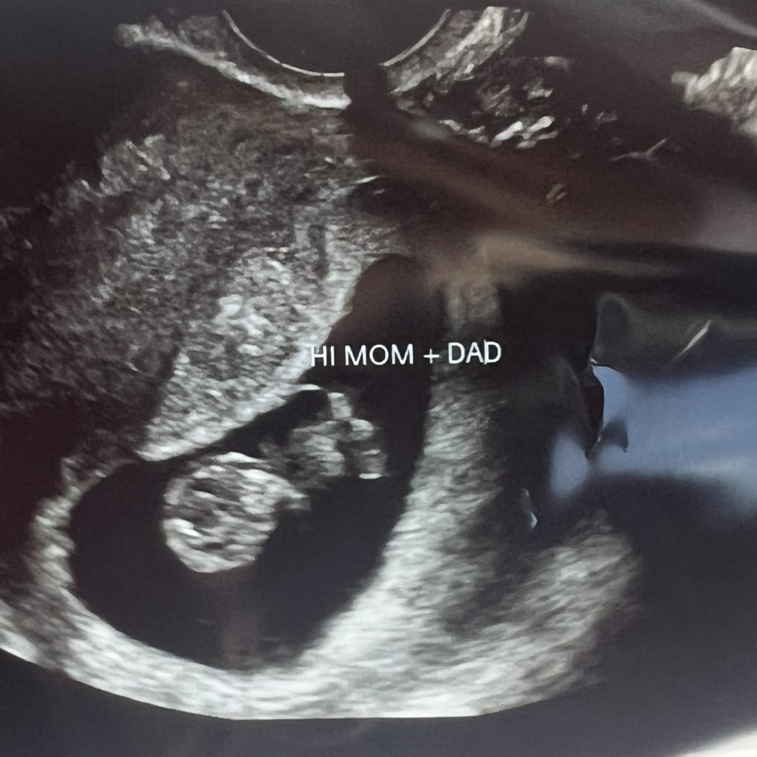 Photo shared by Inayah for their Babylist baby registry.
