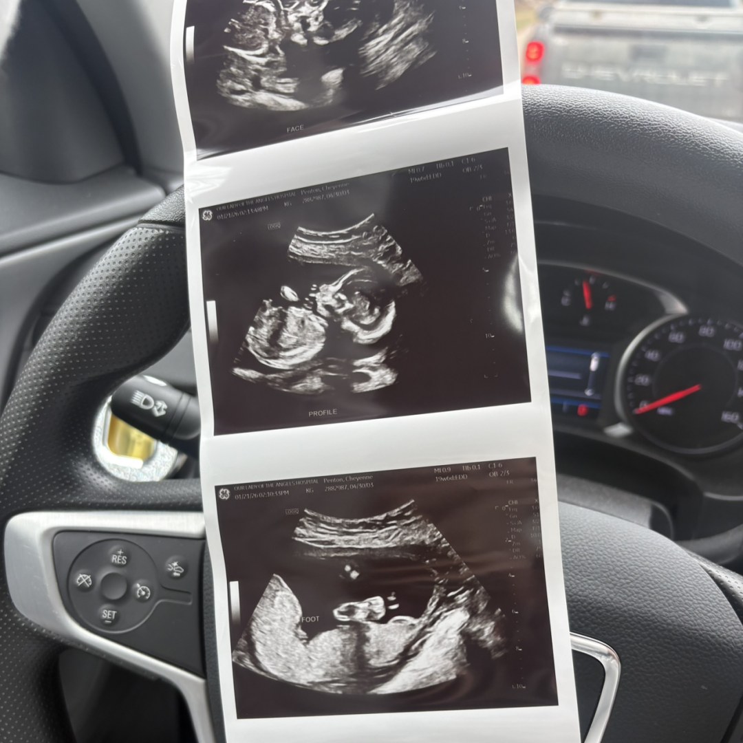 Photo shared by Cheyenne for their Babylist baby registry.