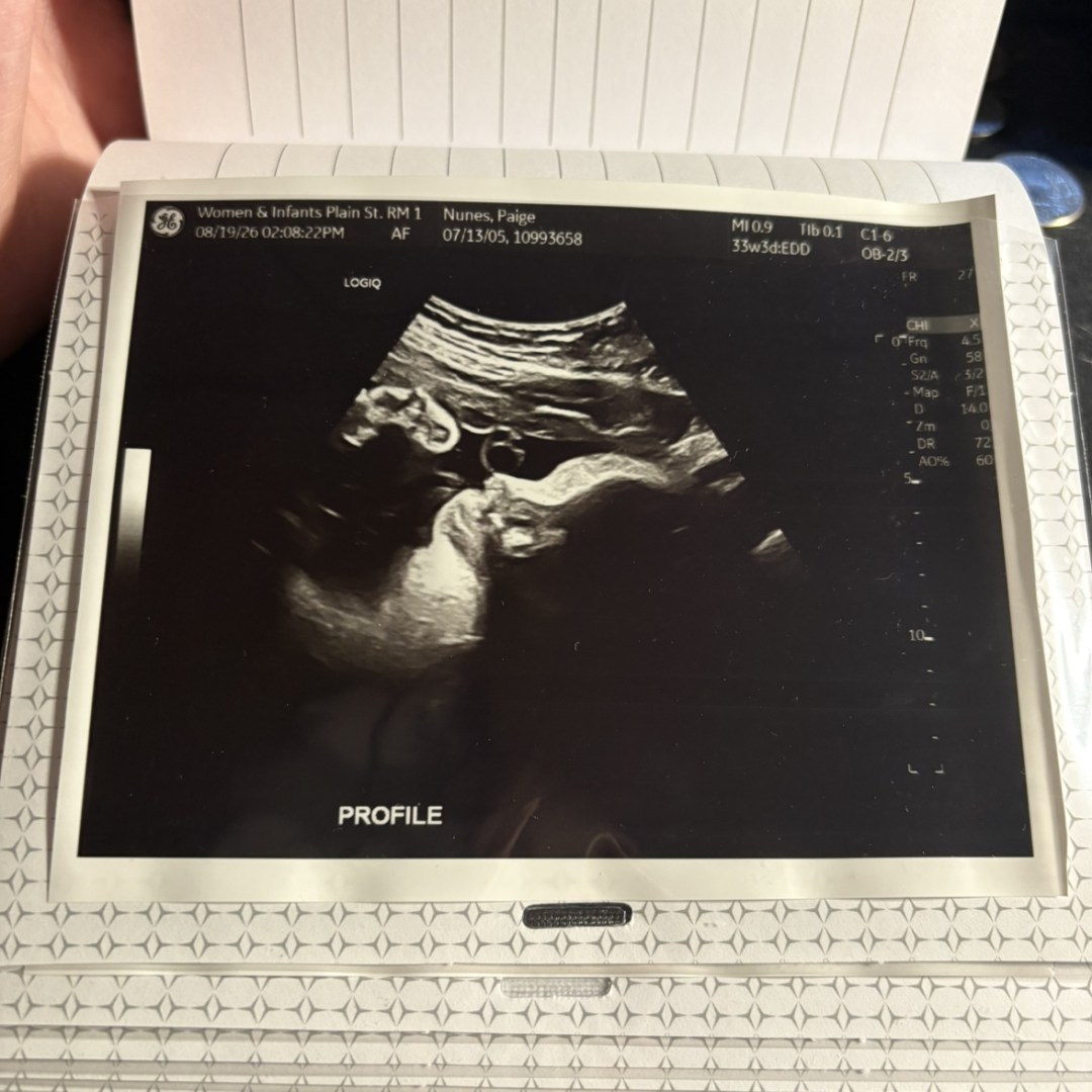 Photo shared by Paige for their Babylist baby registry.