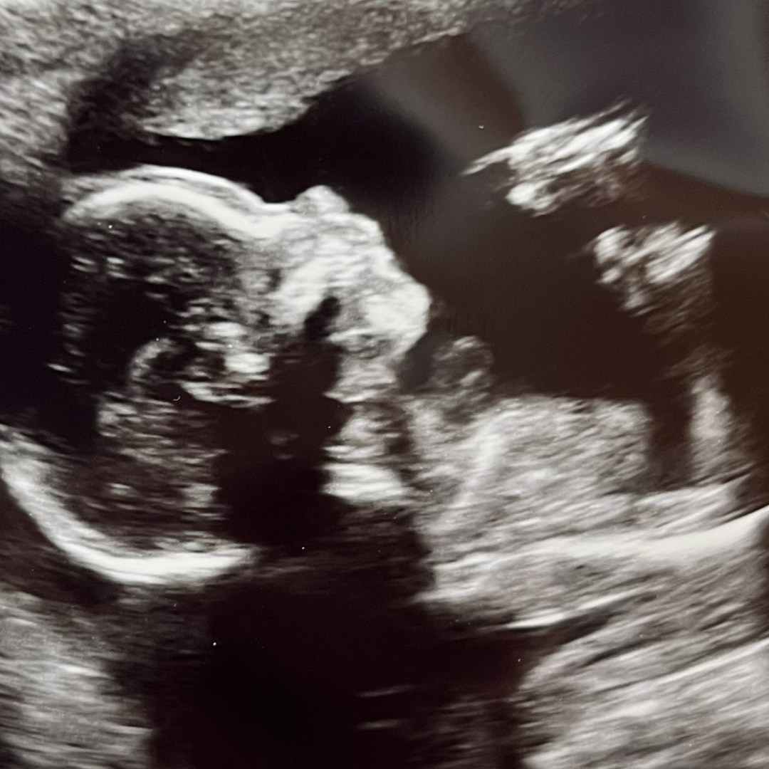 Photo shared by Elly for their Babylist baby registry.