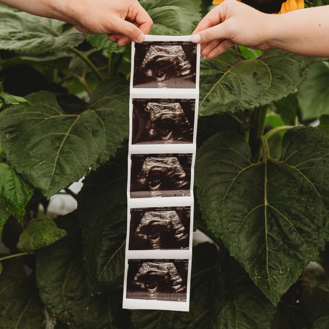 Photo shared by Kasey for their Babylist baby registry.