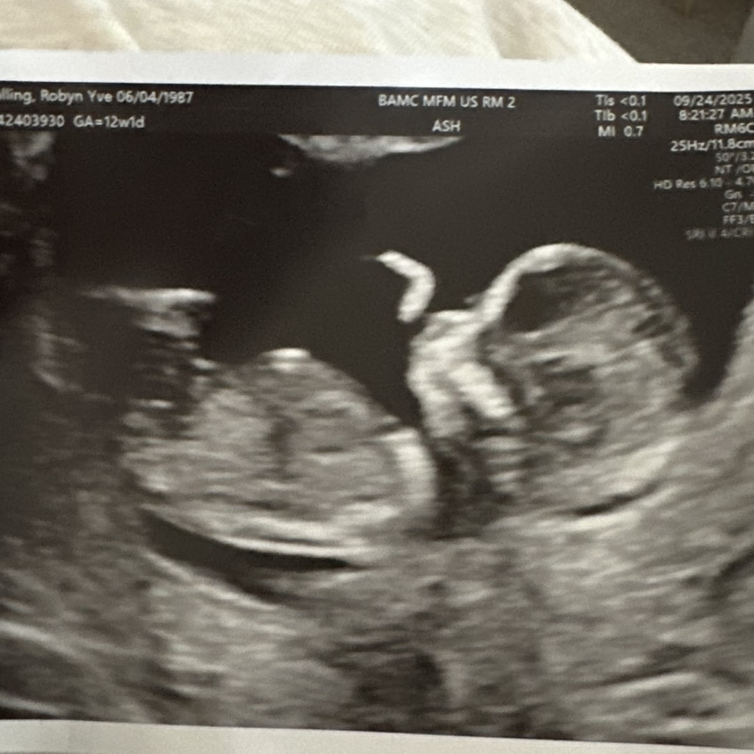 Photo shared by Robyn for their Babylist baby registry.