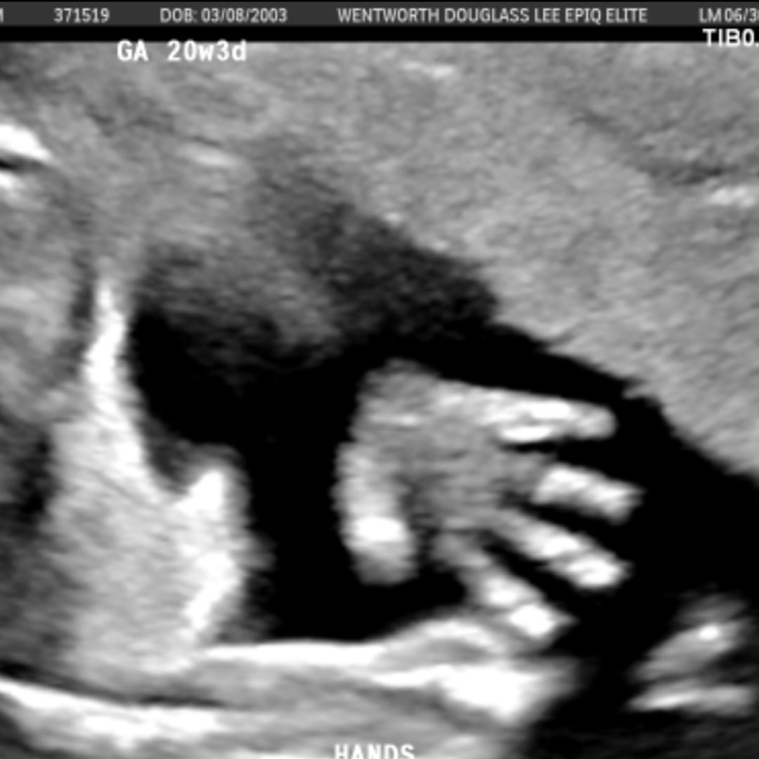 Photo shared by Dee for their Babylist baby registry.
