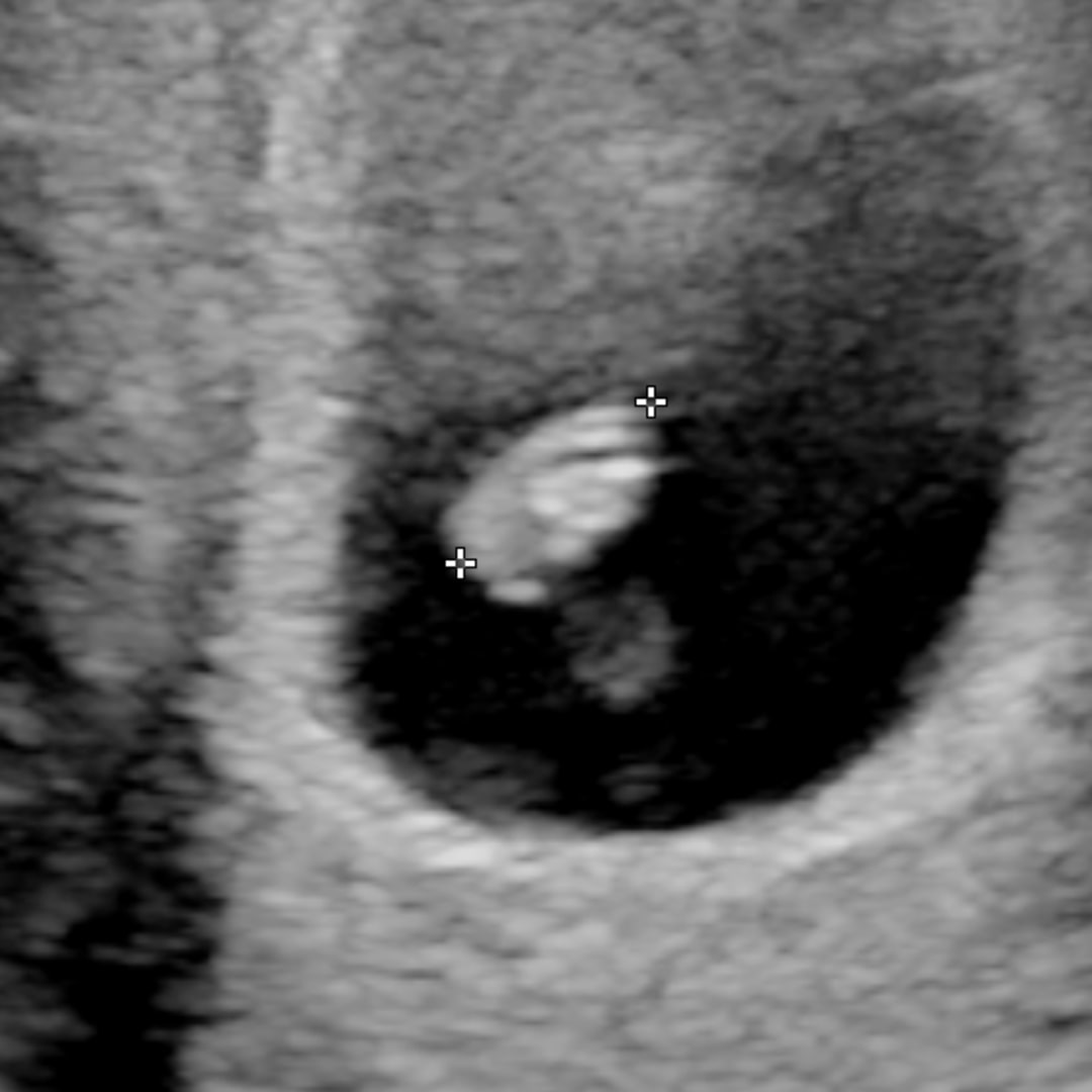 Photo shared by Deiy for their Babylist baby registry.