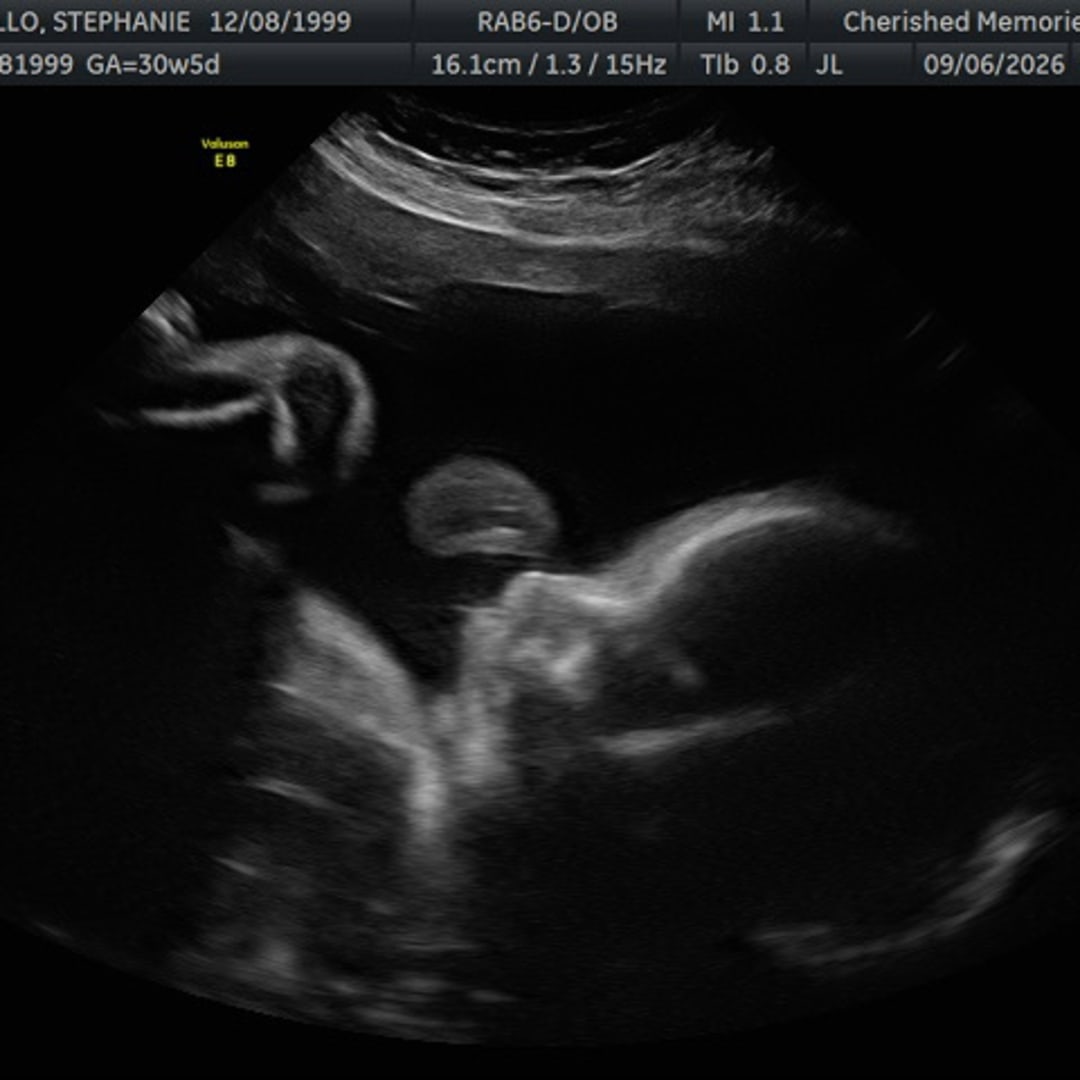 Photo shared by Stephanie for their Babylist baby registry.
