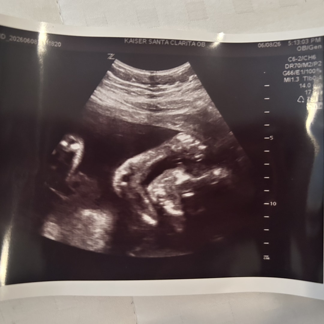 Photo shared by Selene for their Babylist baby registry.