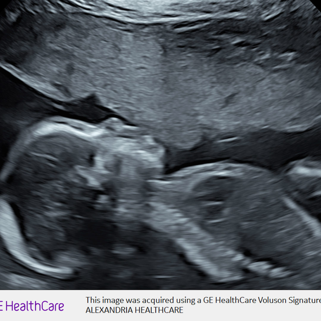 Photo shared by Balee for their Babylist baby registry.
