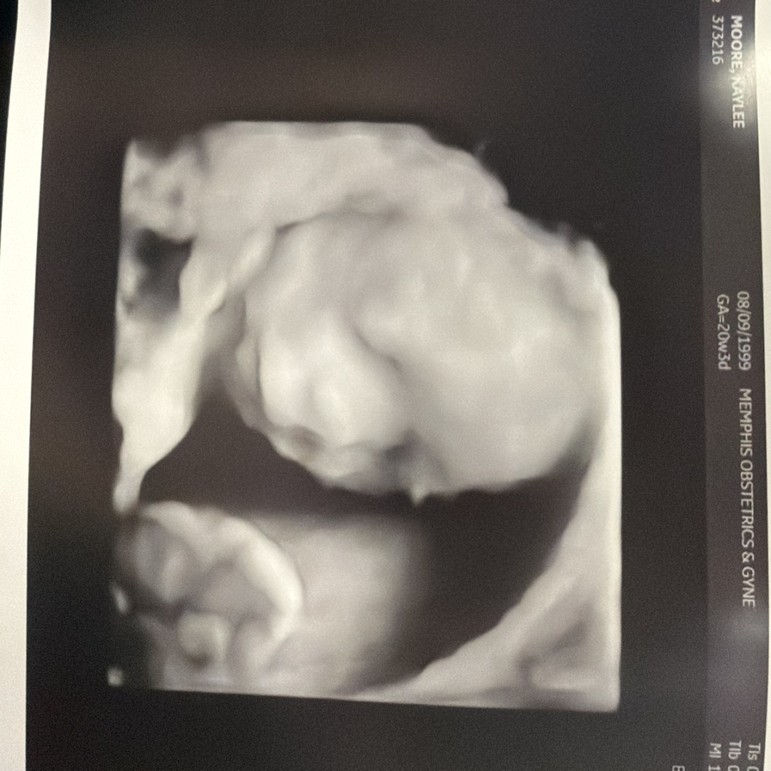 Photo shared by Kaylee for their Babylist baby registry.
