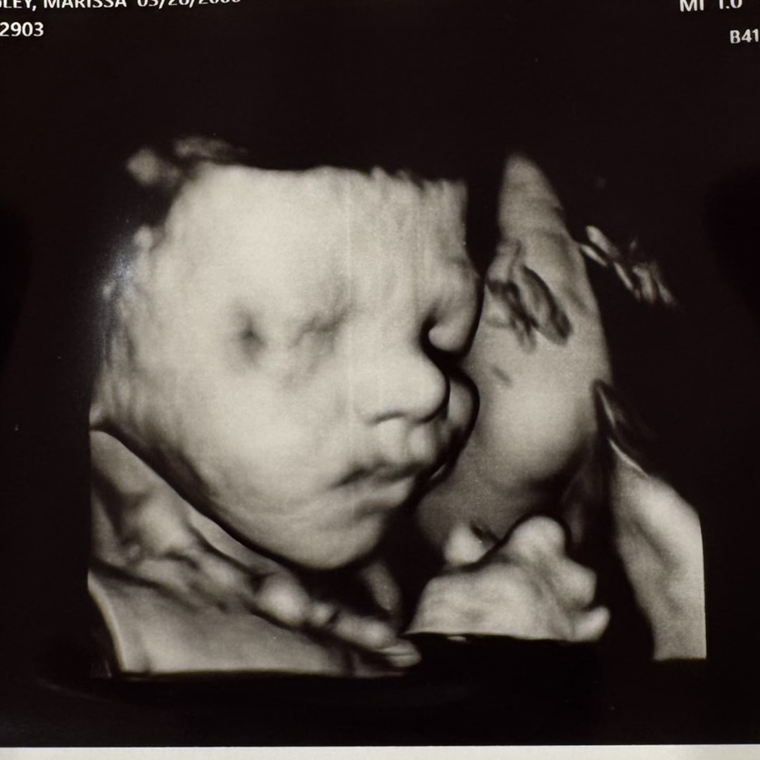 Photo shared by Marissa for their Babylist baby registry.