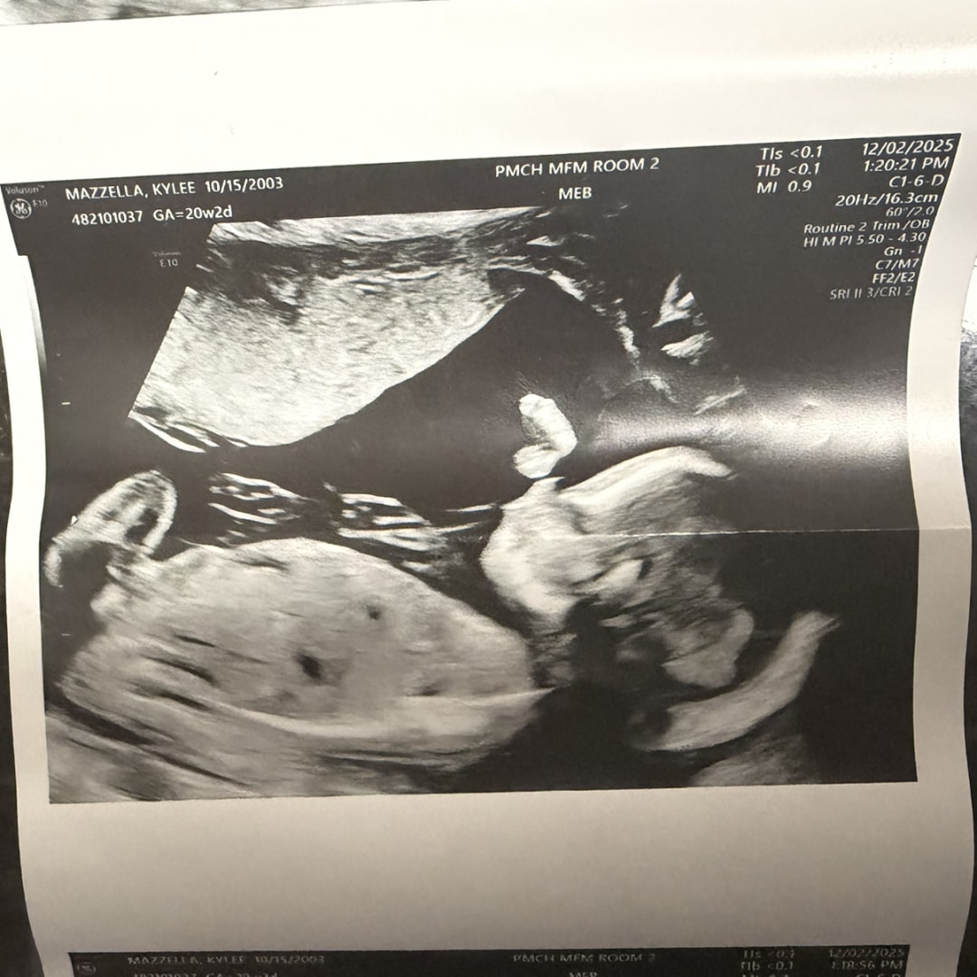 Photo shared by Kylee for their Babylist baby registry.