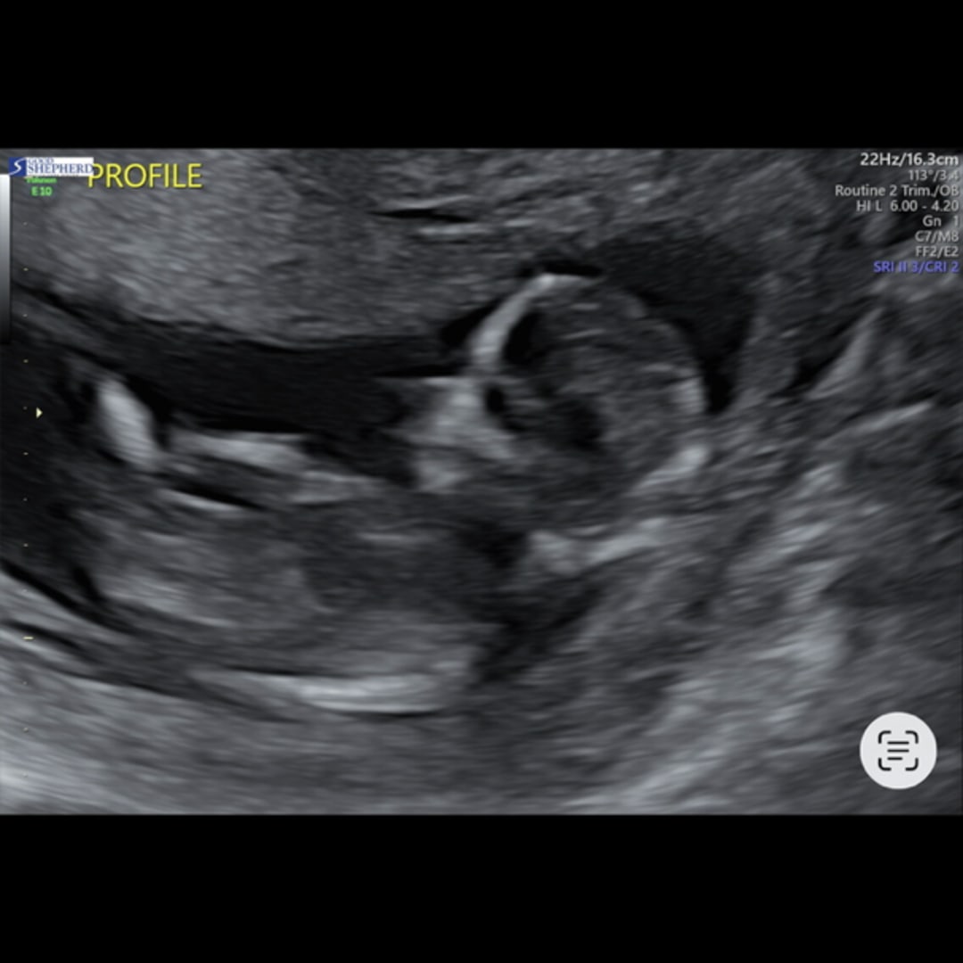 Photo shared by Denise for their Babylist baby registry.