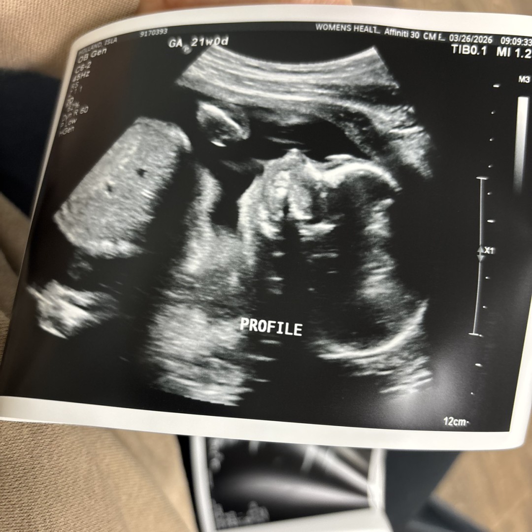 Photo shared by Isla for their Babylist baby registry.