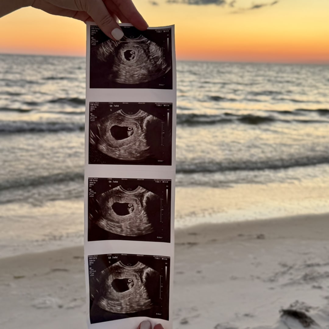 Photo shared by Allison for their Babylist baby registry.