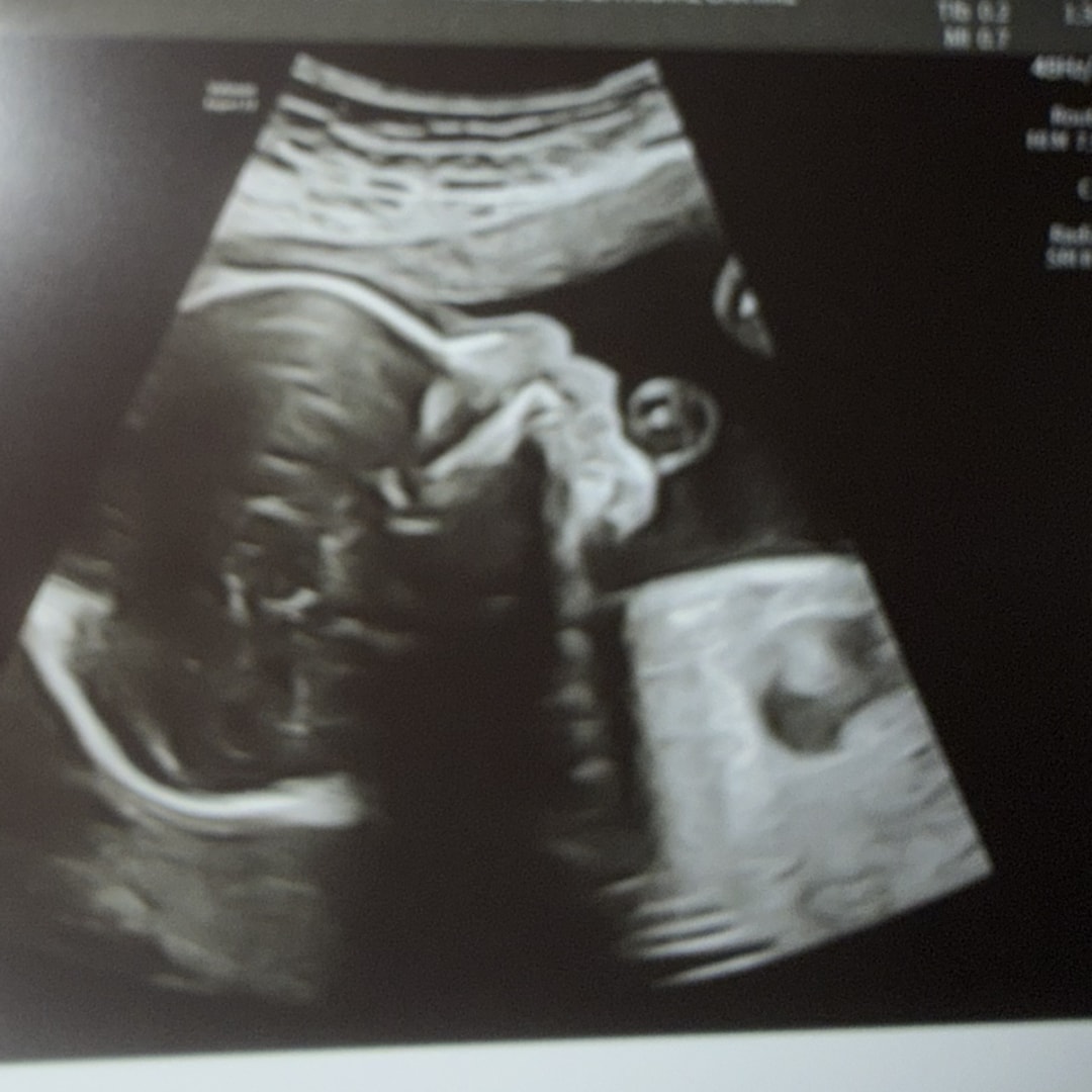 Photo shared by Wilma for their Babylist baby registry.