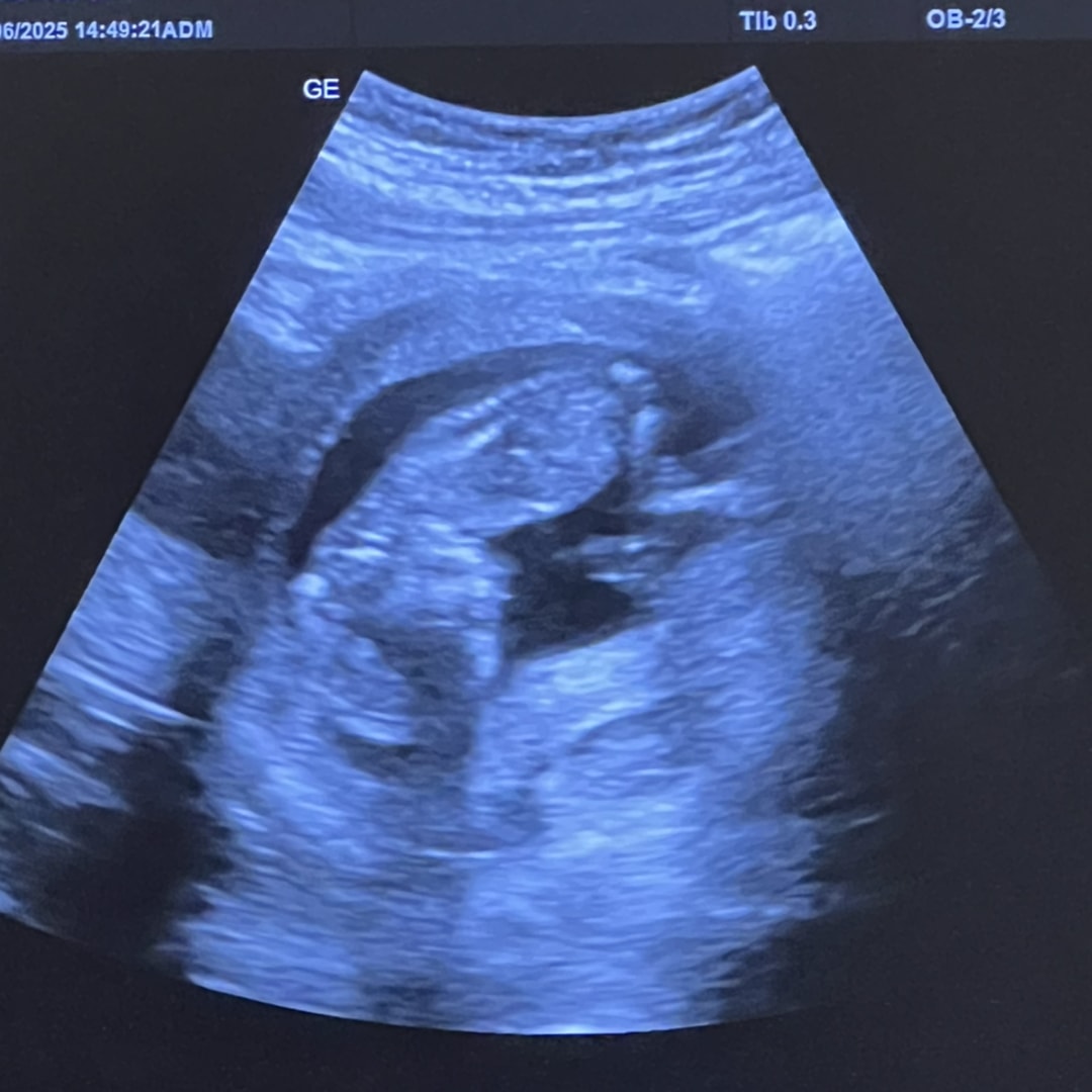 Photo shared by Emily for their Babylist baby registry.