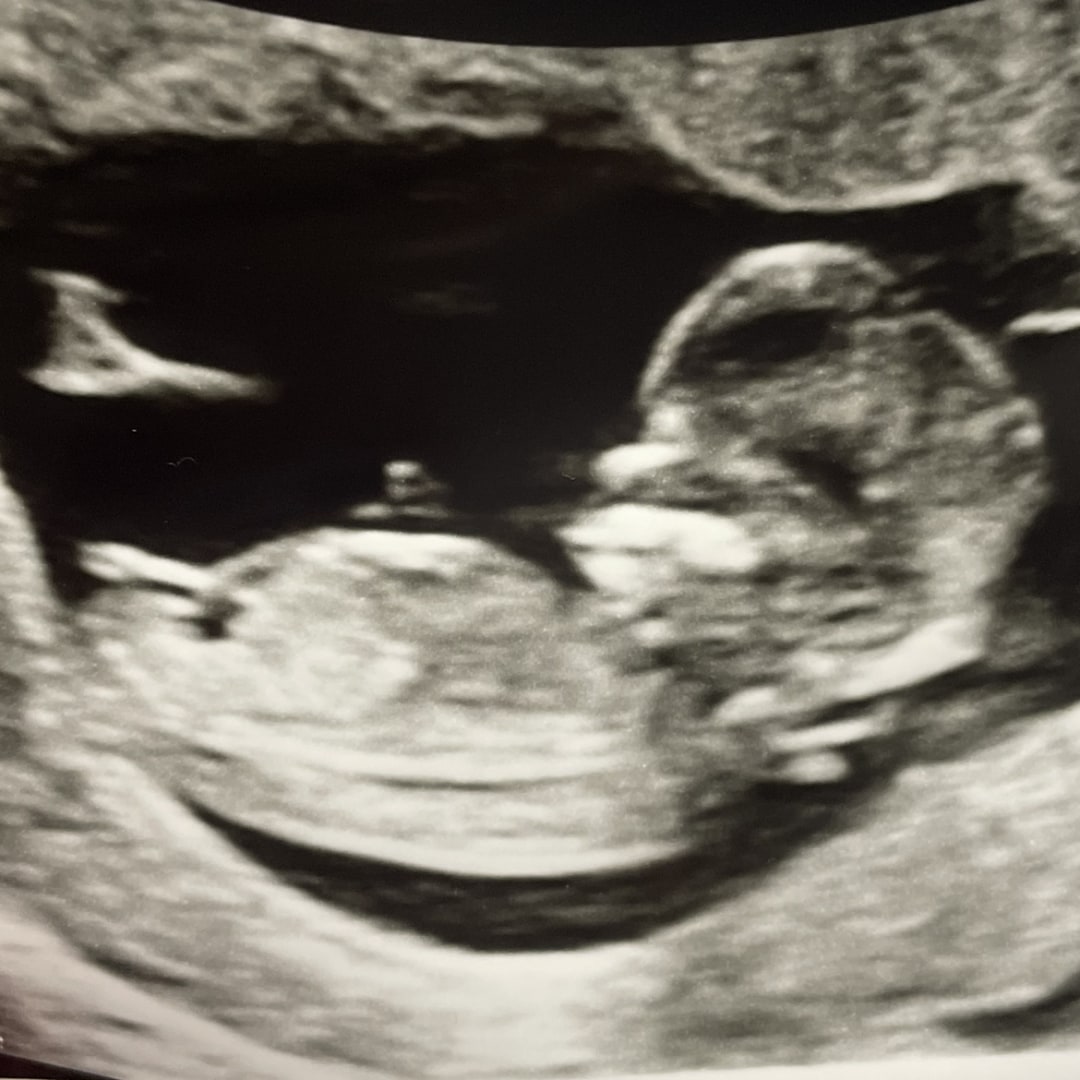 Photo shared by Elise for their Babylist baby registry.