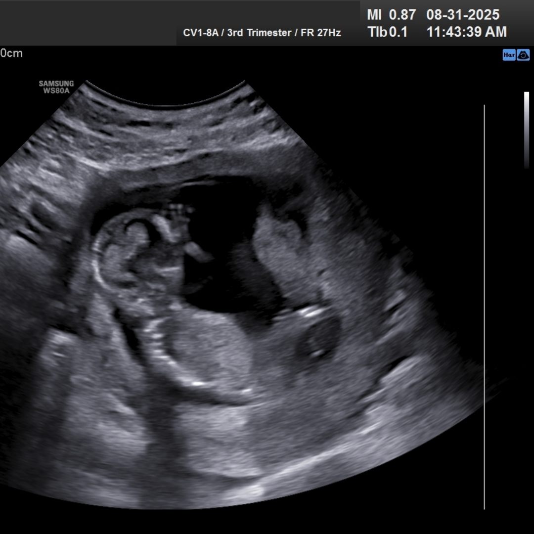 Photo shared by Acie for their Babylist baby registry.