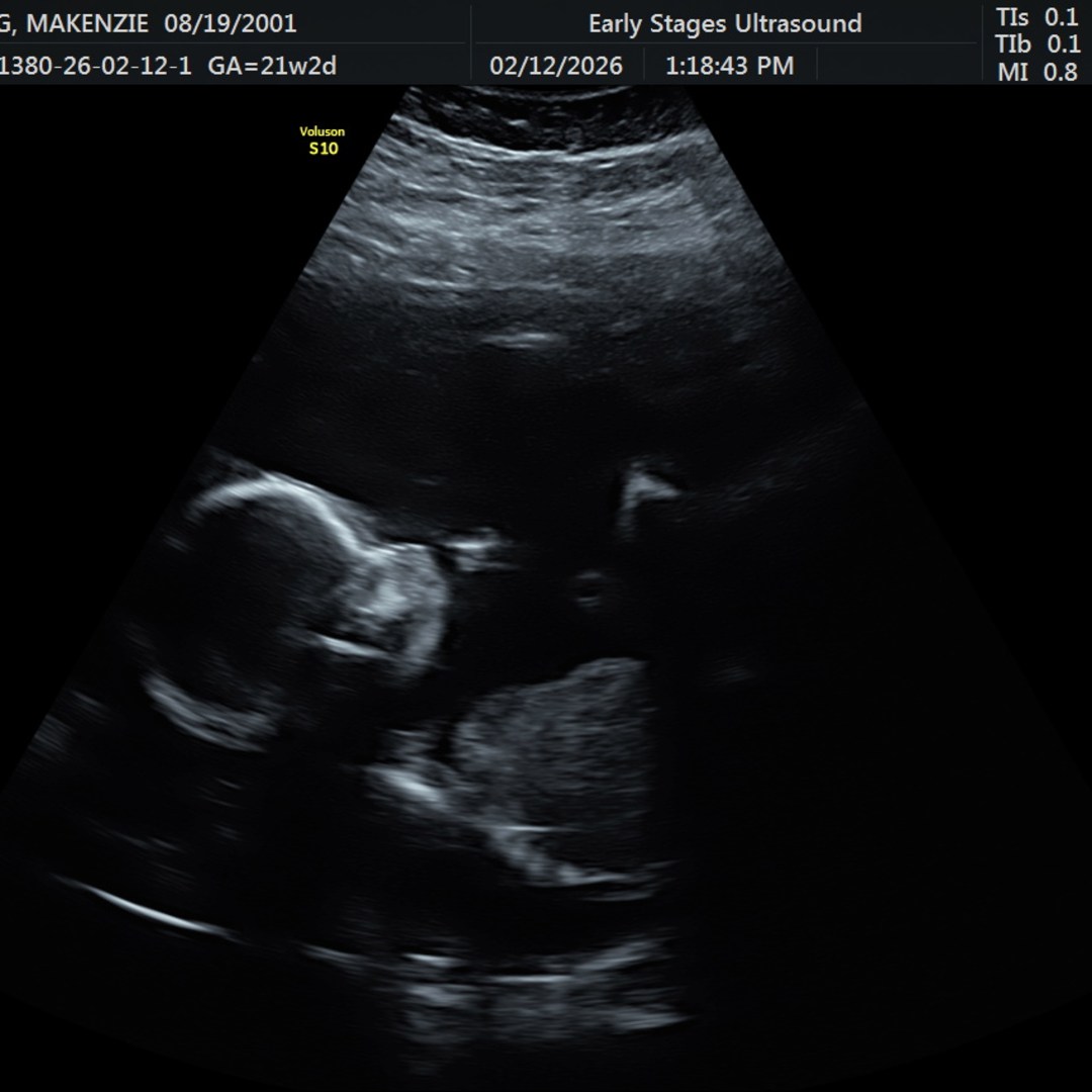 Photo shared by Makenzie for their Babylist baby registry.