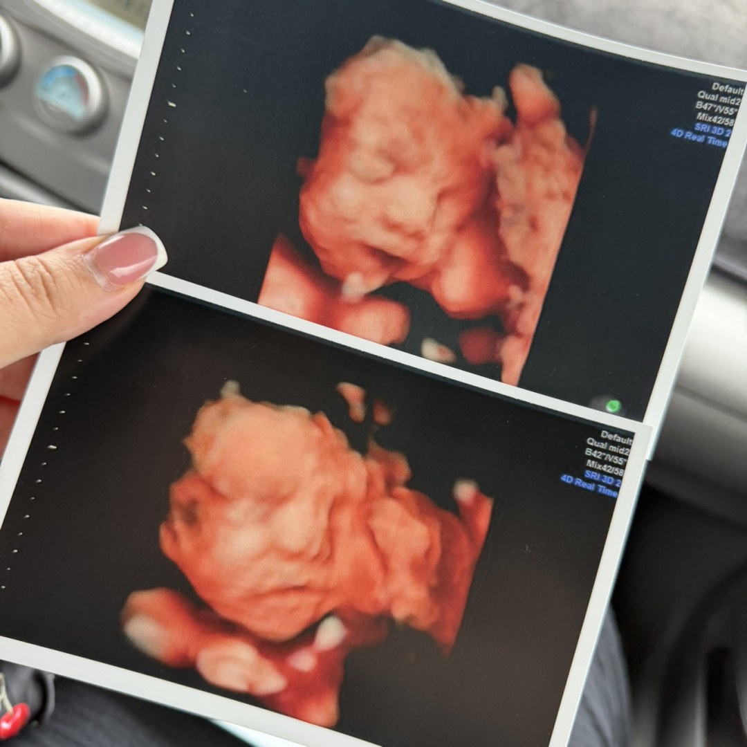 Photo shared by Ashley for their Babylist baby registry.