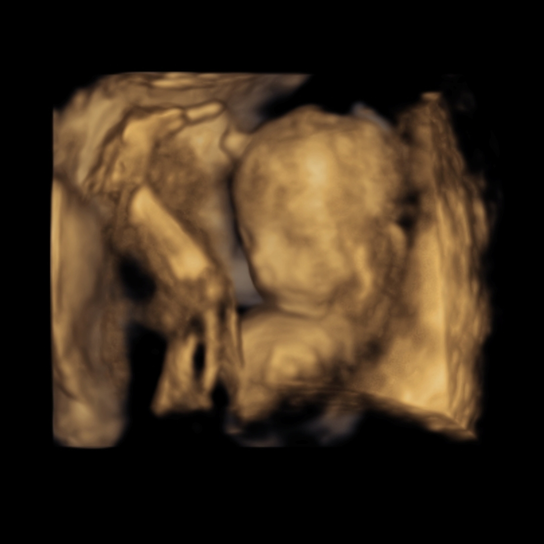 Photo shared by Brittany for their Babylist baby registry.