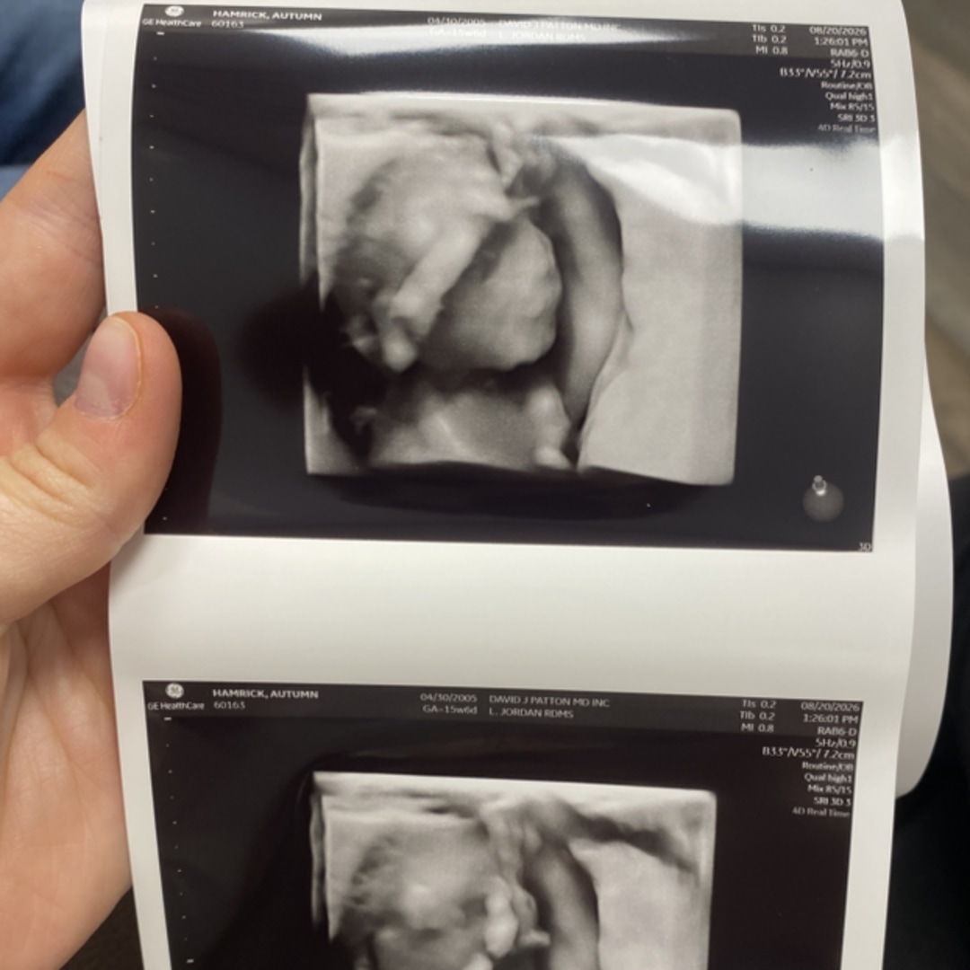 Photo shared by Autumn for their Babylist baby registry.