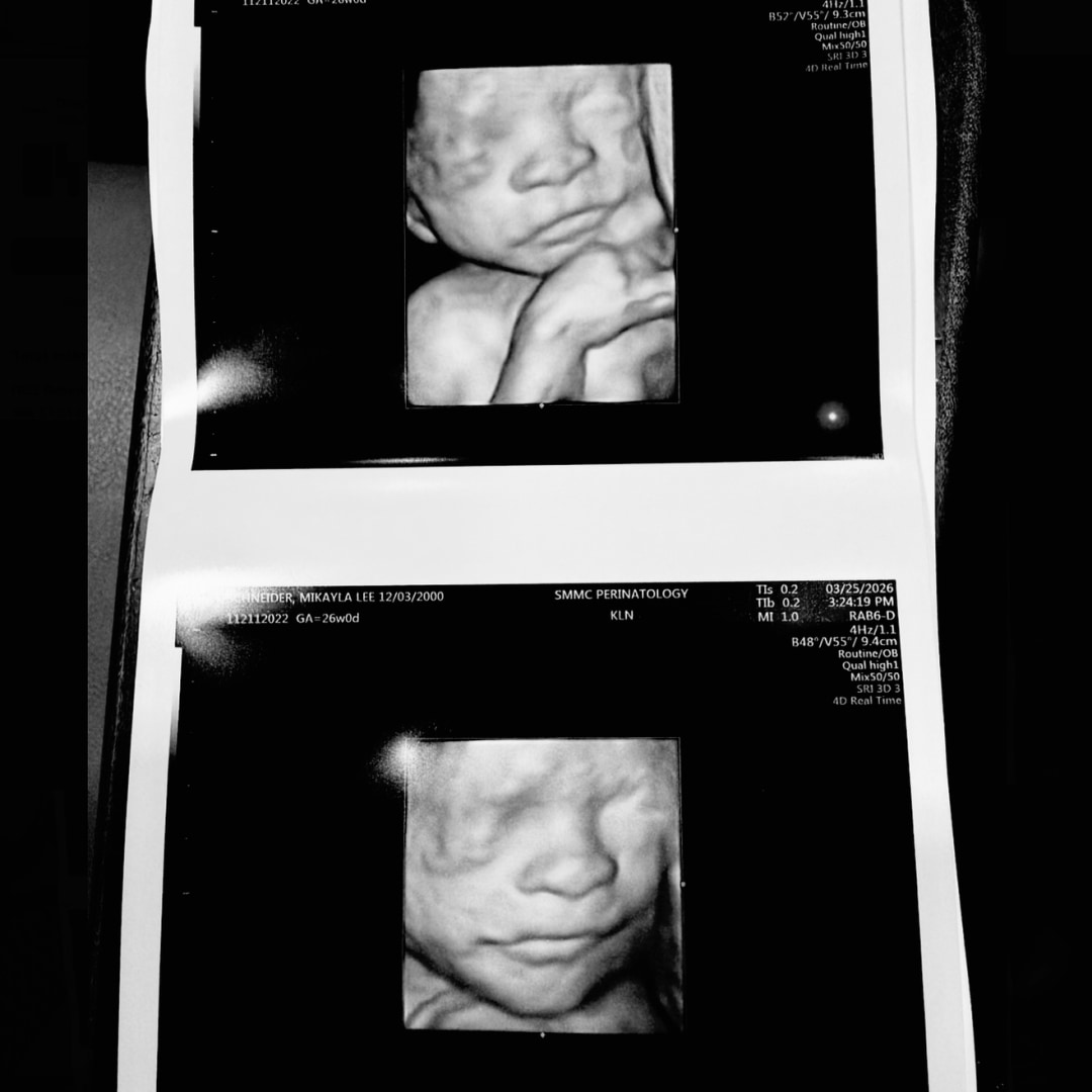 Photo shared by Mikayla for their Babylist baby registry.