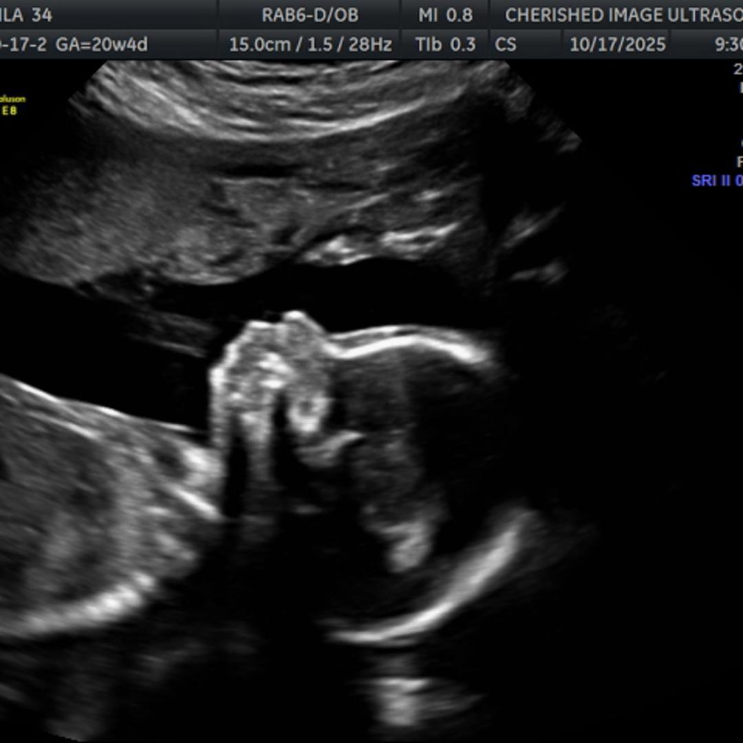 Photo shared by Kaila for their Babylist baby registry.