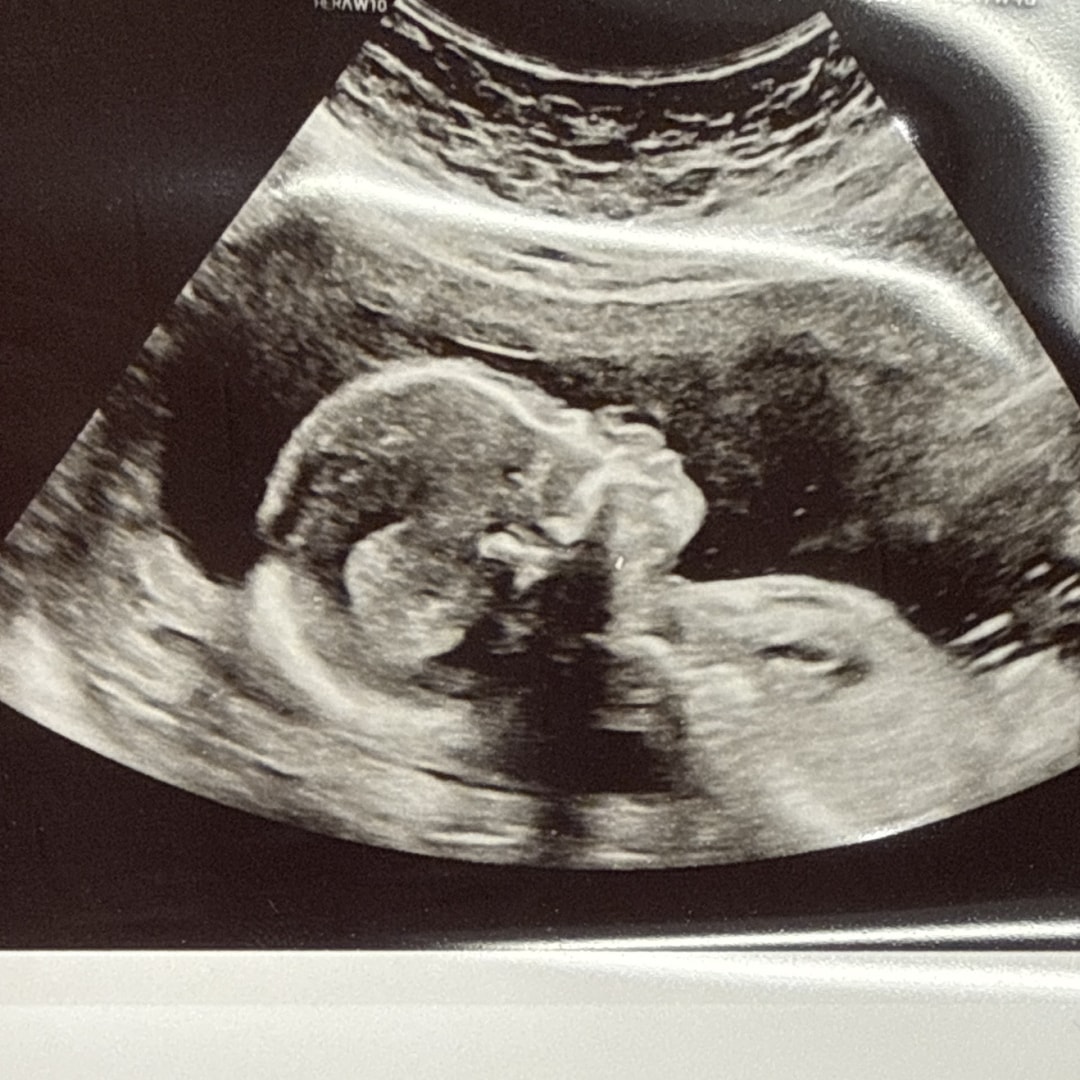 Photo shared by Jazzalyn for their Babylist baby registry.