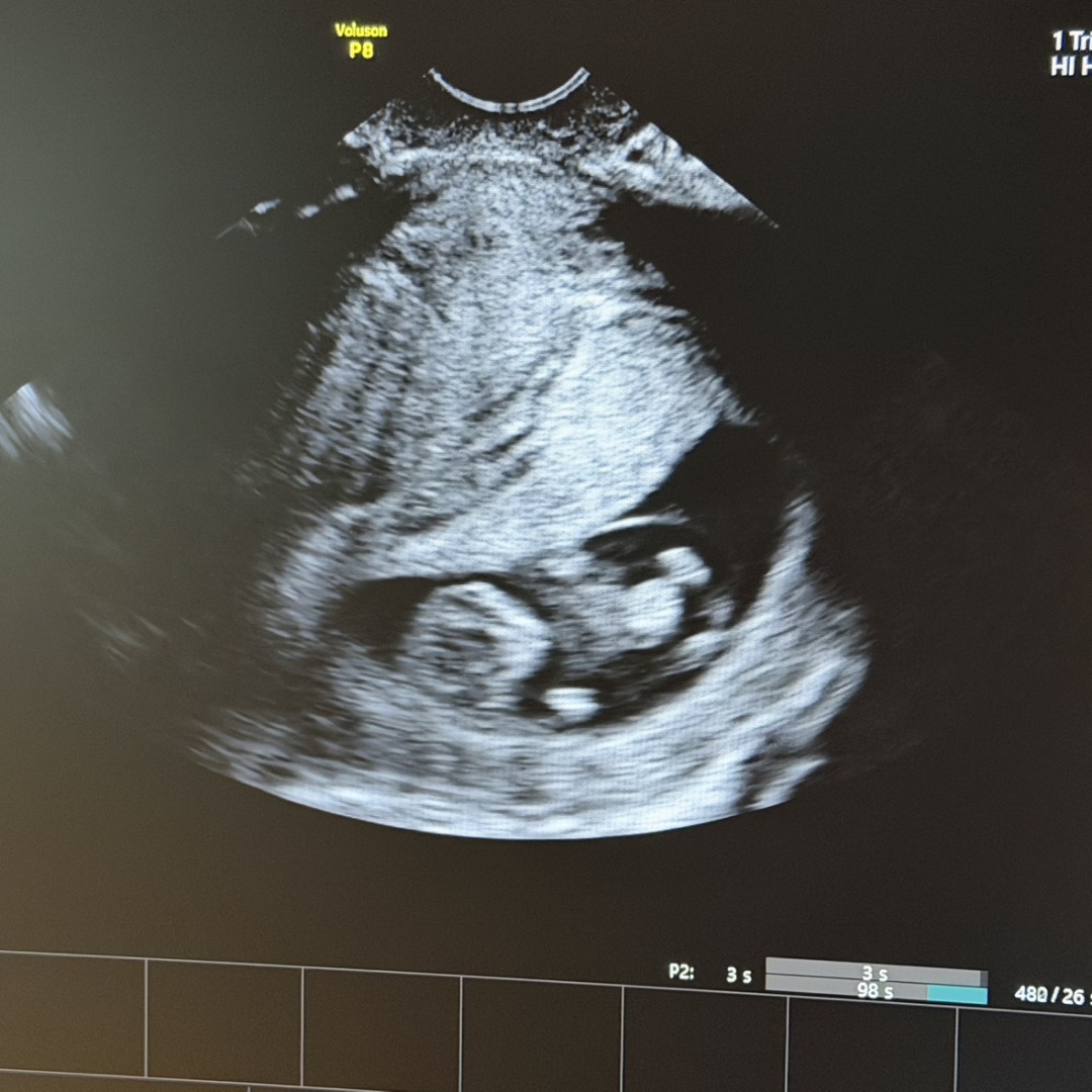 Photo shared by Michelle for their Babylist baby registry.