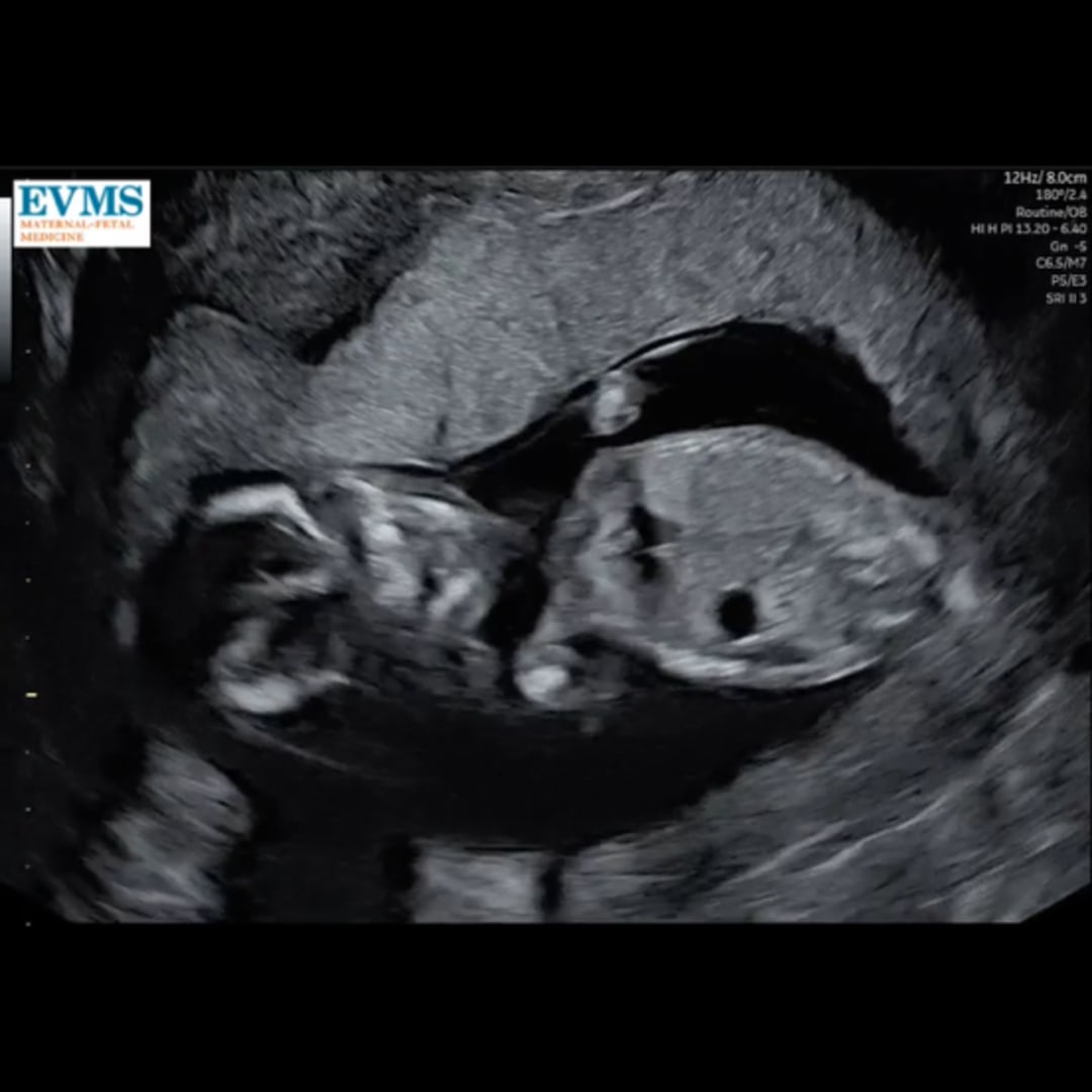 Photo shared by Lindsey for their Babylist baby registry.