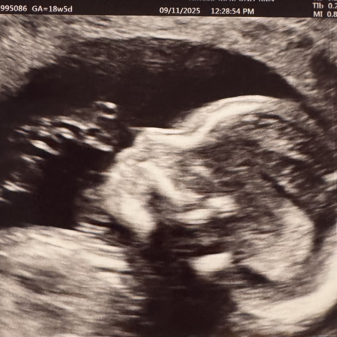 Photo shared by Maria for their Babylist baby registry.