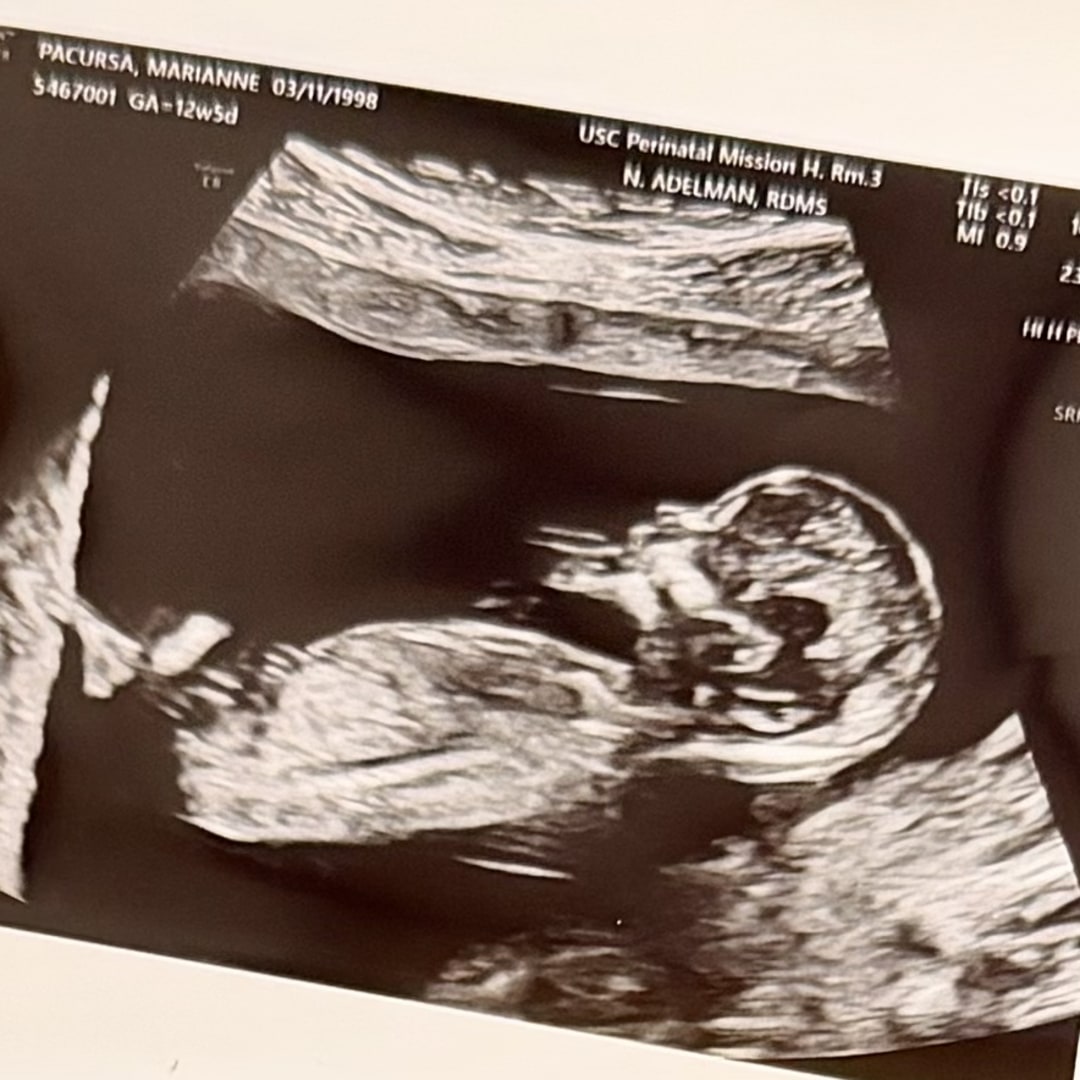 Photo shared by Marianne for their Babylist baby registry.