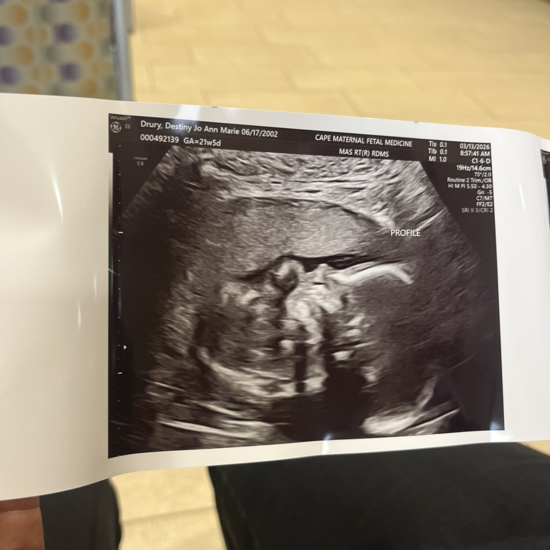 Photo shared by Destiny for their Babylist baby registry.